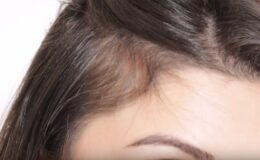 Şampuana bunu karıştırırsanız saç dökülmesi şak diye duruyor!