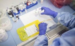 Kanser hücrelerini yakalayan ‘akıllı çip’ yöntemi klinik aşamaya geçti