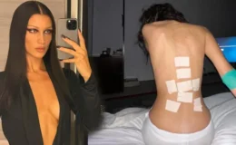 Bella Hadid hastanelik oldu! Son hali sosyal medyada gündem oldu