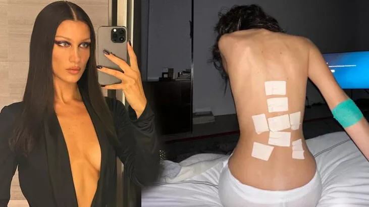 Bella Hadid hastanelik oldu! Son hali sosyal medyada gündem oldu