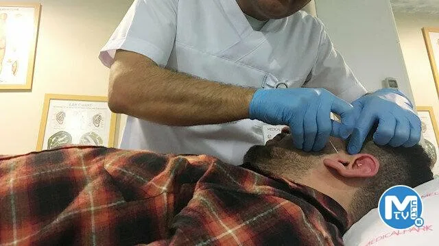 Akupunkturla 40 kilo verdi, artık yemek yerken utanmıyor