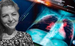 Aynı gün içinde hem kanser teşhisi aldı, hem tedavi edildi!  ‘Sadece 3 gün boyunca ağrı kesici aldım’