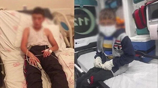 Bitlis’te köpek saldırısına uğrayan çocuğun babası konuştu: Bilseydik daha önce götürürdük