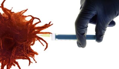 Bilim insanları kişiye özel kanser tedavisi üzerine çalışıyor