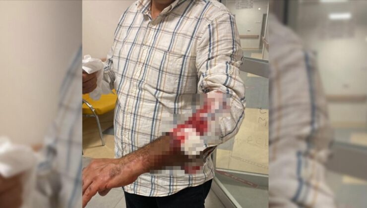 Parkta köpek dehşeti! Kaçtı ama kurtulamadı