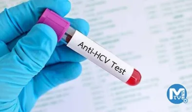Anti HCV nedir?