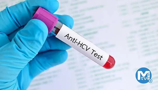 Anti HCV nedir?