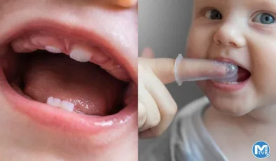 Diş çıkarma: Bebeğinizin ilk dişleri