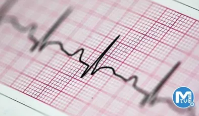 EKG nedir, nasıl çekilir? EKG neden çekilir?