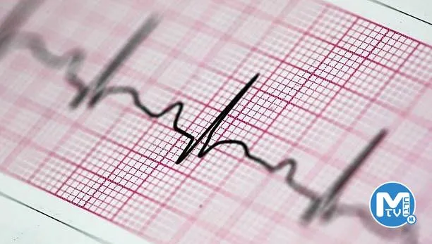EKG nedir, nasıl çekilir? EKG neden çekilir?
