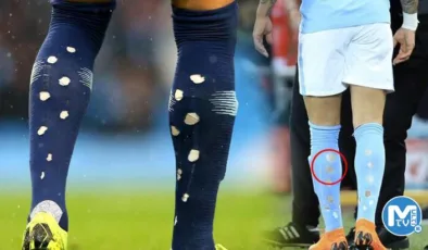 Futbolcuların tozluklarını yırtmasının nedeni!