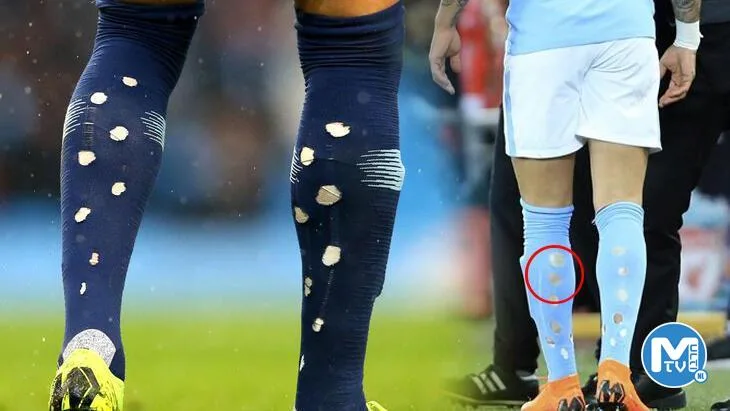 Futbolcuların tozluklarını yırtmasının nedeni!