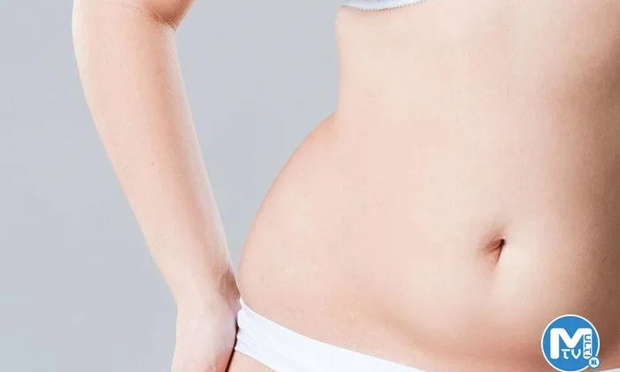 Karın Germe Ameliyatı Sonrası İyileşme Süreci