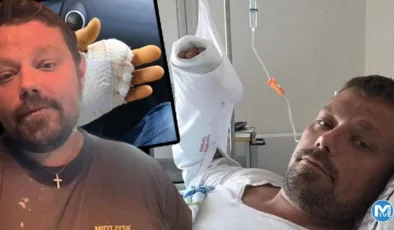 Kedi ısırığı sonrası hayatını kaybetti! 15 ameliyat geçirdi, parmağı kesildi ama kurtulamadı…