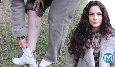Köpeklerin saldırısında yaralanan Duygu, yaşananları anlattı