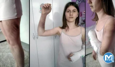 Önce beyzbol sopası ile dövdü, sonra rezalet mesajları attı! ‘Yapmazsam adam değilim’