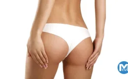 Yağ Enjeksiyonu Nedir, Hangi Bölgelere Yapılır?