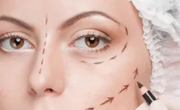 Yüz Germe Ameliyatı