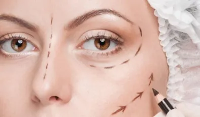 Yüz Germe Ameliyatı