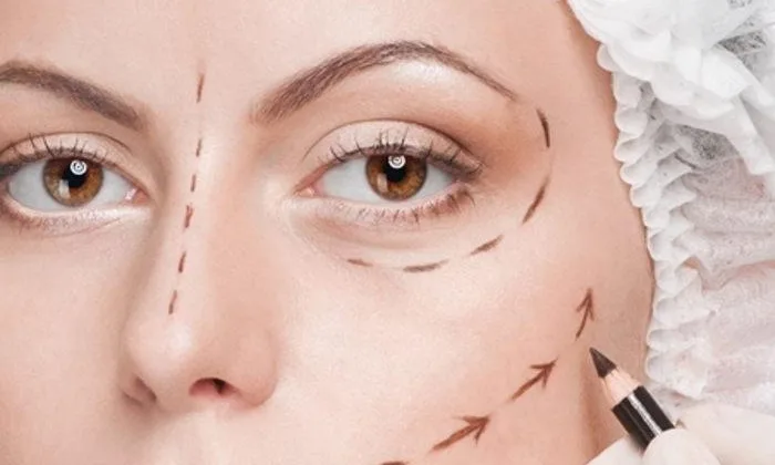 Yüz Germe Ameliyatı