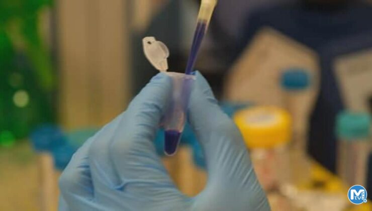 Aziz Sancar’ın keşfi kanseri önleyen ilaca dönüşüyor!