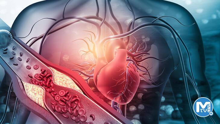 Kalp damarlarındaki tıkanıklığın ilk sinyaline dikkat! Gençlerde de görülüyor