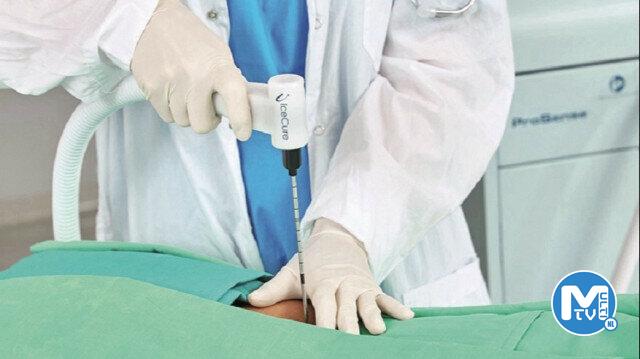 Kanserli dokuya buz tedavisi: -140 ile donduruluyor