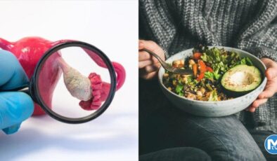 PCOS ile Nasıl Kilo Verilir?