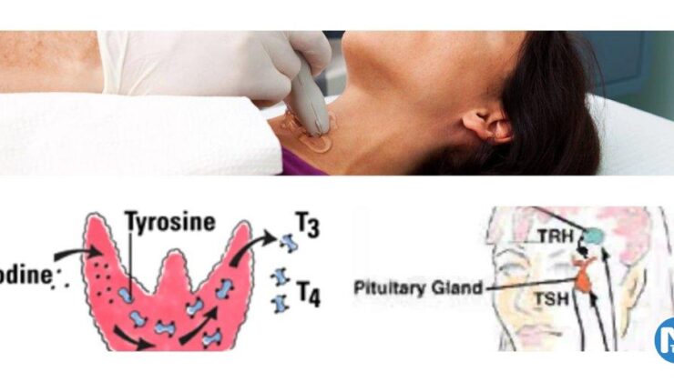 Tiroid Bezi Fonksiyon Testleri