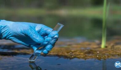 Kolera hastalığı belirtileri? Kolera virüsü insandan insana bulaşır mı? Türkiye’de kolera