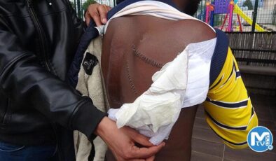 Yunan askerlerinin sırtından bıçakladığı Abdullah’a 30 dikiş atıldı