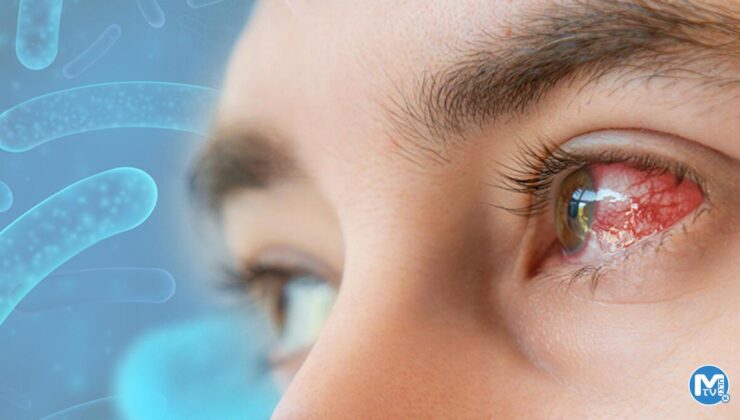 ABD’yi alarma geçiren bakteri: Gözün içinde eriyor!  18 eyalette 81 kişide görüldü, 4 kişi hayatını kaybetti