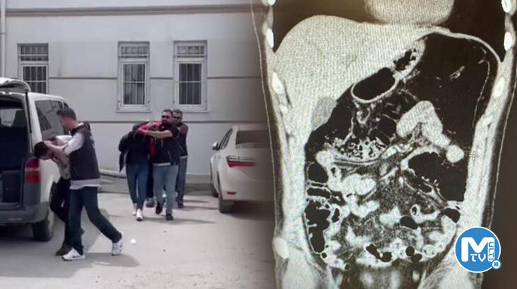 Midesinde eroinle yakalandı, ‘Ben içici değil, yutucuyum’ dedi