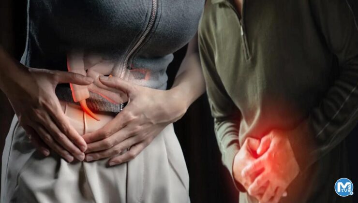 Apandisit neden olur, nedir? Apandisit belirtileri nelerdir? Apandisit patlaması…